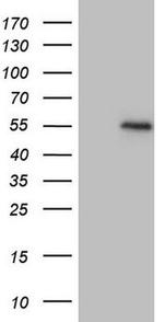 Myostatin Antibody in Western Blot (WB)