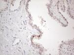 CtBP2 Antibody in Immunohistochemistry (Paraffin) (IHC (P))