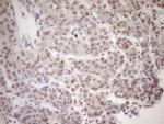 PCQAP Antibody in Immunohistochemistry (Paraffin) (IHC (P))