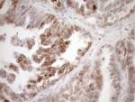 PCQAP Antibody in Immunohistochemistry (Paraffin) (IHC (P))