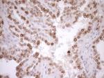 PCQAP Antibody in Immunohistochemistry (Paraffin) (IHC (P))