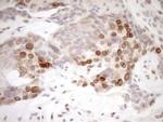 PCQAP Antibody in Immunohistochemistry (Paraffin) (IHC (P))