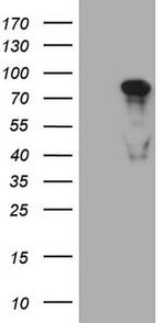 PCQAP Antibody in Western Blot (WB)