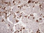 Kindlin 3 Antibody in Immunohistochemistry (Paraffin) (IHC (P))