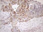 SDHB Antibody in Immunohistochemistry (Paraffin) (IHC (P))