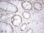 PSMG2 Antibody in Immunohistochemistry (Paraffin) (IHC (P))