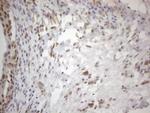 WTAP Antibody in Immunohistochemistry (Paraffin) (IHC (P))