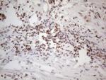 WTAP Antibody in Immunohistochemistry (Paraffin) (IHC (P))