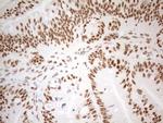 WTAP Antibody in Immunohistochemistry (Paraffin) (IHC (P))