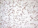 WTAP Antibody in Immunohistochemistry (Paraffin) (IHC (P))