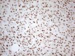 WTAP Antibody in Immunohistochemistry (Paraffin) (IHC (P))