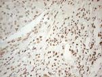 WTAP Antibody in Immunohistochemistry (Paraffin) (IHC (P))