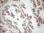 WTAP Antibody in Immunohistochemistry (Paraffin) (IHC (P))