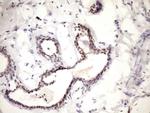 WTAP Antibody in Immunohistochemistry (Paraffin) (IHC (P))