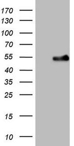 WTAP Antibody in Western Blot (WB)