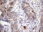 XRCC6BP1 Antibody in Immunohistochemistry (Paraffin) (IHC (P))