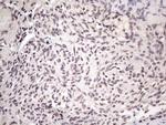 SRSF9 Antibody in Immunohistochemistry (Paraffin) (IHC (P))