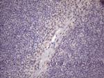 SRSF9 Antibody in Immunohistochemistry (Paraffin) (IHC (P))