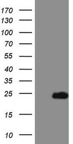 TCAP Antibody in Western Blot (WB)