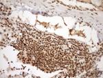 SYF2 Antibody in Immunohistochemistry (Paraffin) (IHC (P))