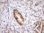 SYF2 Antibody in Immunohistochemistry (Paraffin) (IHC (P))