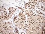 SYF2 Antibody in Immunohistochemistry (Paraffin) (IHC (P))