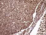 SYF2 Antibody in Immunohistochemistry (Paraffin) (IHC (P))