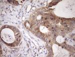 TRBP Antibody in Immunohistochemistry (Paraffin) (IHC (P))