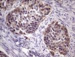 AMTN Antibody in Immunohistochemistry (Paraffin) (IHC (P))