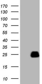 AMTN Antibody in Western Blot (WB)