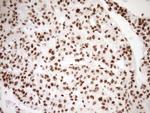 EXOSC1 Antibody in Immunohistochemistry (Paraffin) (IHC (P))