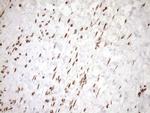 EXOSC1 Antibody in Immunohistochemistry (Paraffin) (IHC (P))