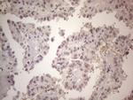 ERCC8 Antibody in Immunohistochemistry (Paraffin) (IHC (P))