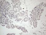 ERCC8 Antibody in Immunohistochemistry (Paraffin) (IHC (P))