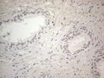 ERCC8 Antibody in Immunohistochemistry (Paraffin) (IHC (P))