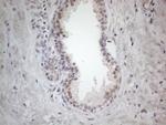 ERCC8 Antibody in Immunohistochemistry (Paraffin) (IHC (P))