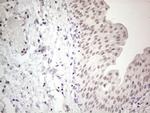 ERCC8 Antibody in Immunohistochemistry (Paraffin) (IHC (P))