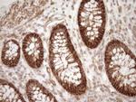 EPLIN Antibody in Immunohistochemistry (Paraffin) (IHC (P))