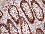 EPLIN Antibody in Immunohistochemistry (Paraffin) (IHC (P))