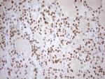 UTP11L Antibody in Immunohistochemistry (Paraffin) (IHC (P))