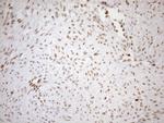 UTP11L Antibody in Immunohistochemistry (Paraffin) (IHC (P))