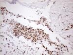 UTP11L Antibody in Immunohistochemistry (Paraffin) (IHC (P))