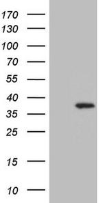 UTP11L Antibody in Western Blot (WB)