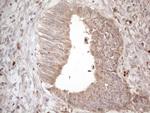 AMTN Antibody in Immunohistochemistry (Paraffin) (IHC (P))