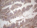 RBMS1 Antibody in Immunohistochemistry (Paraffin) (IHC (P))