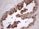 RBMS1 Antibody in Immunohistochemistry (Paraffin) (IHC (P))