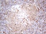 RBMS1 Antibody in Immunohistochemistry (Paraffin) (IHC (P))