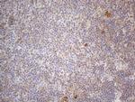 RBMS1 Antibody in Immunohistochemistry (Paraffin) (IHC (P))