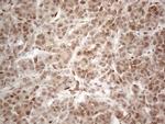 RBMS1 Antibody in Immunohistochemistry (Paraffin) (IHC (P))