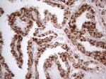 MCEE Antibody in Immunohistochemistry (Paraffin) (IHC (P))